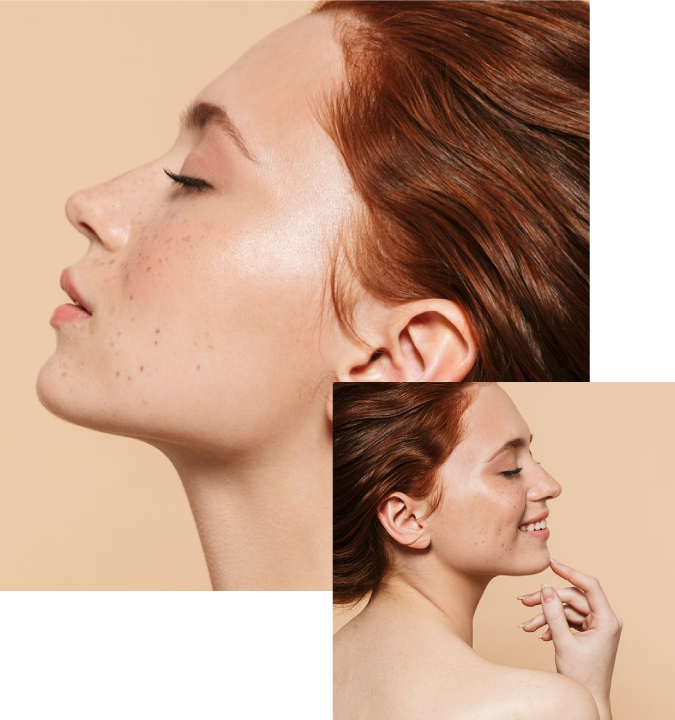 Ultherapy Lifting facial sin cirugía Ultherapy Lifting facial sin cirugía